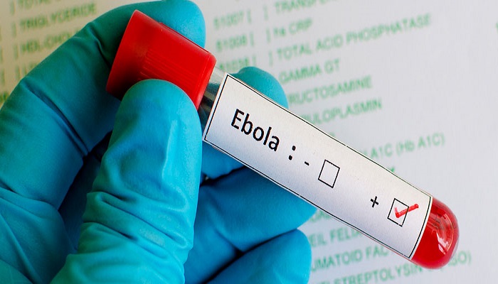 Ebola virus symptoms and treatment